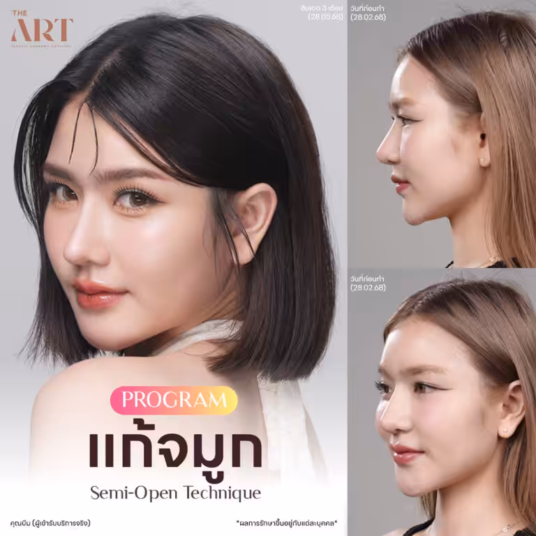 จมูก Triple Lock6