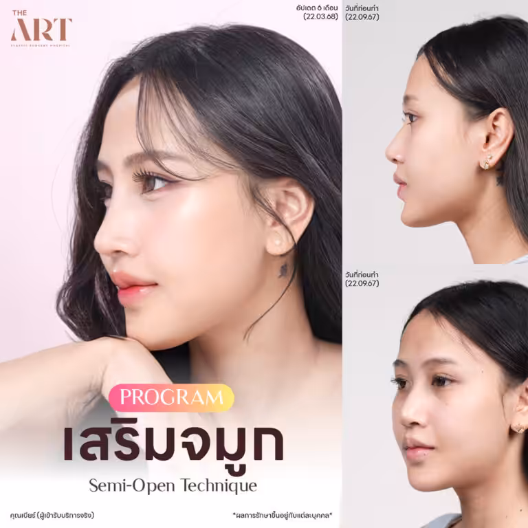 จมูก Triple Lock9