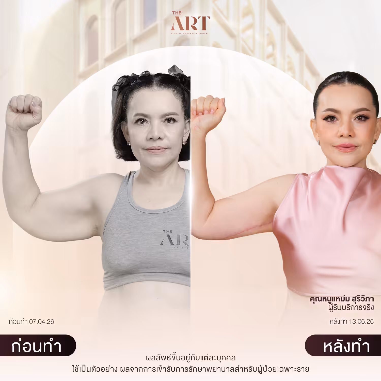 T652 แฉ_BAหนูแหม่ม_02 (3) (1)