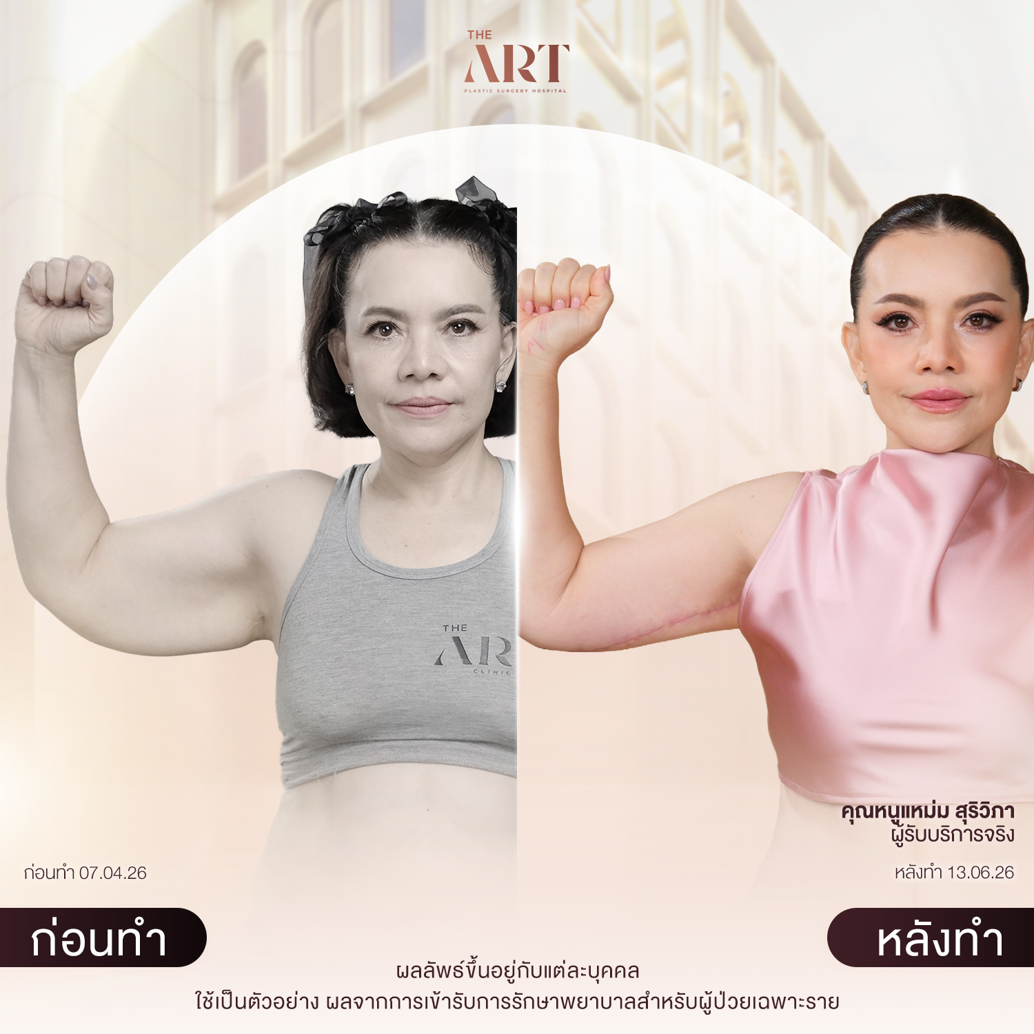T652 แฉ_BAหนูแหม่ม_02 (3) (1)