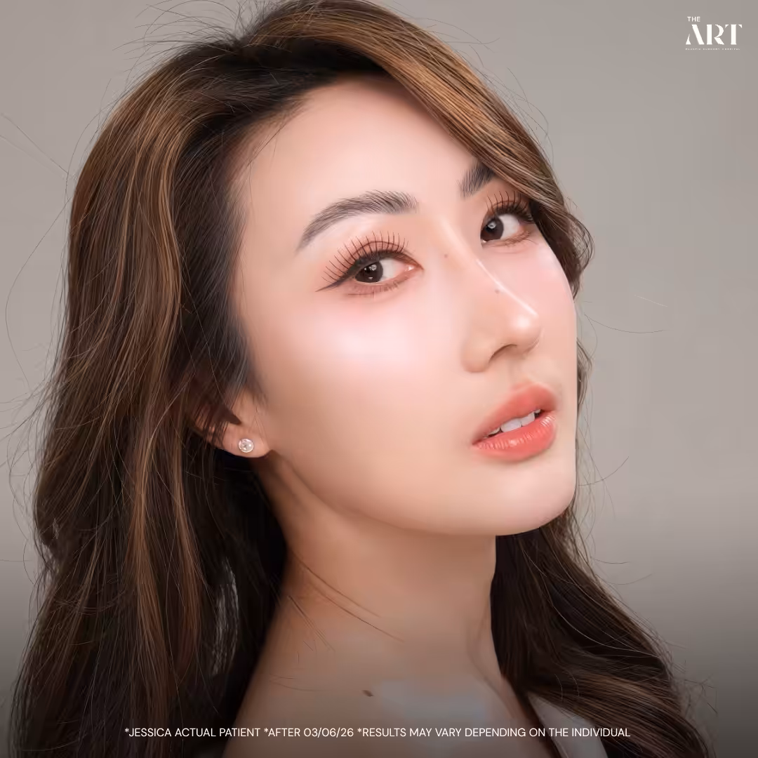 Jesskia_nose surgery