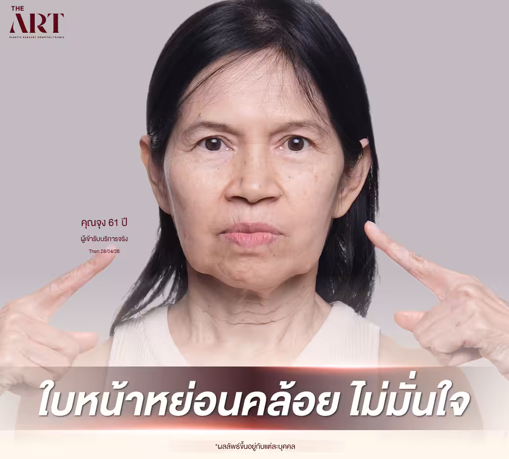 Surgery Wars ดึงหน้า