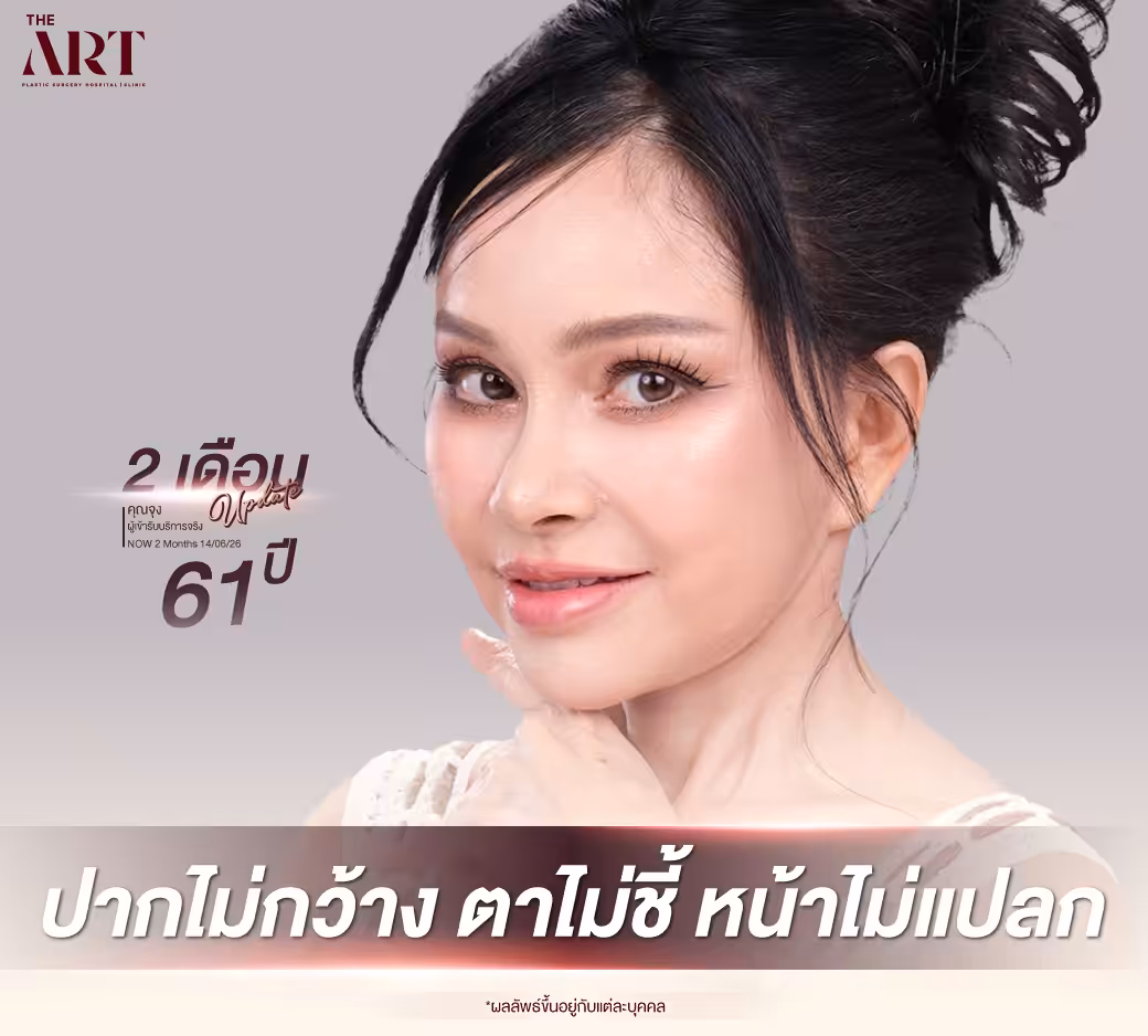 Surgery Wars ดึงหน้า
