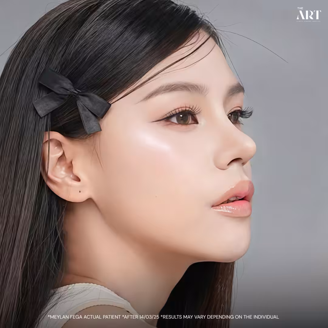 infu_lifestyle The Art Nose Surgery