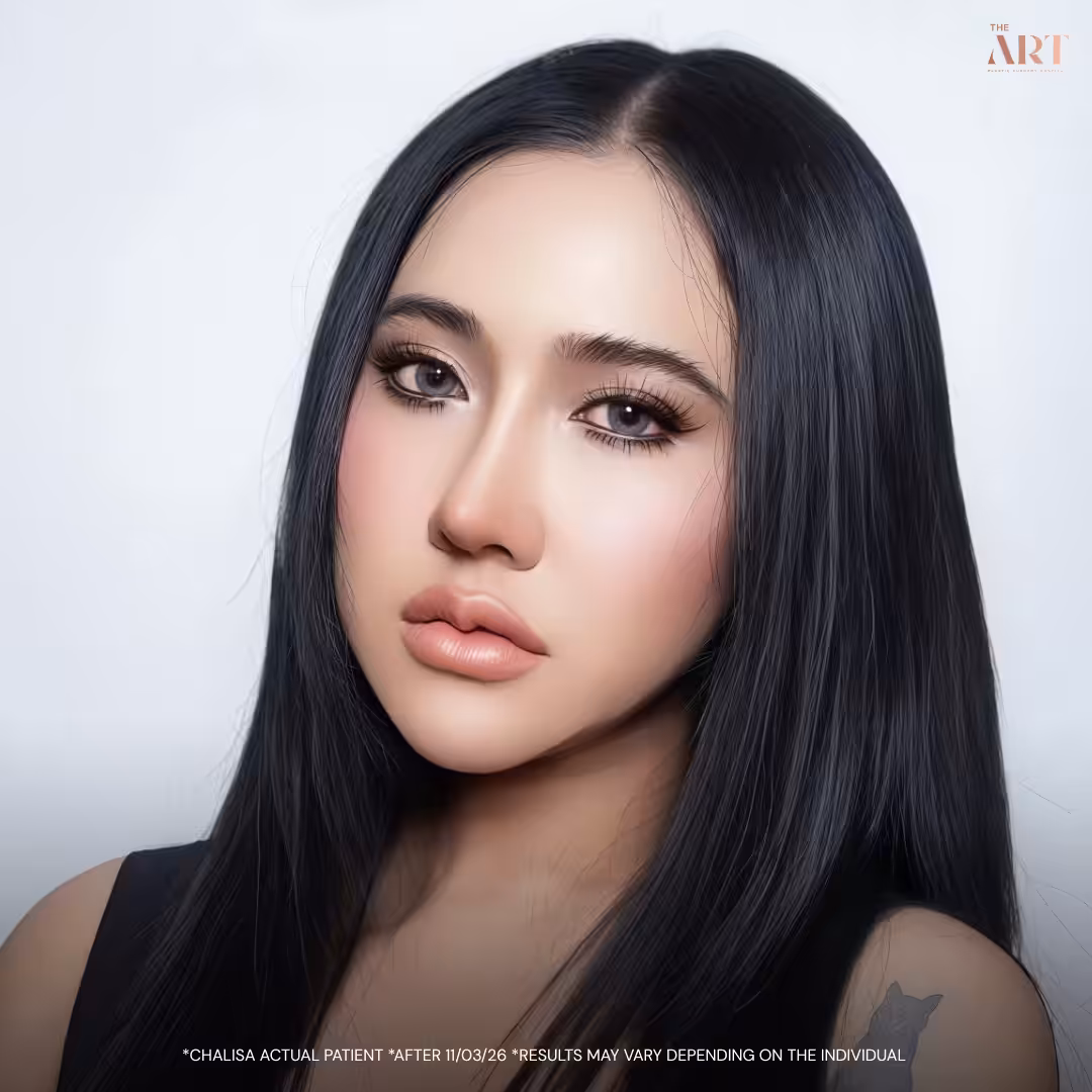 infu_lifestyle Nose Surgery