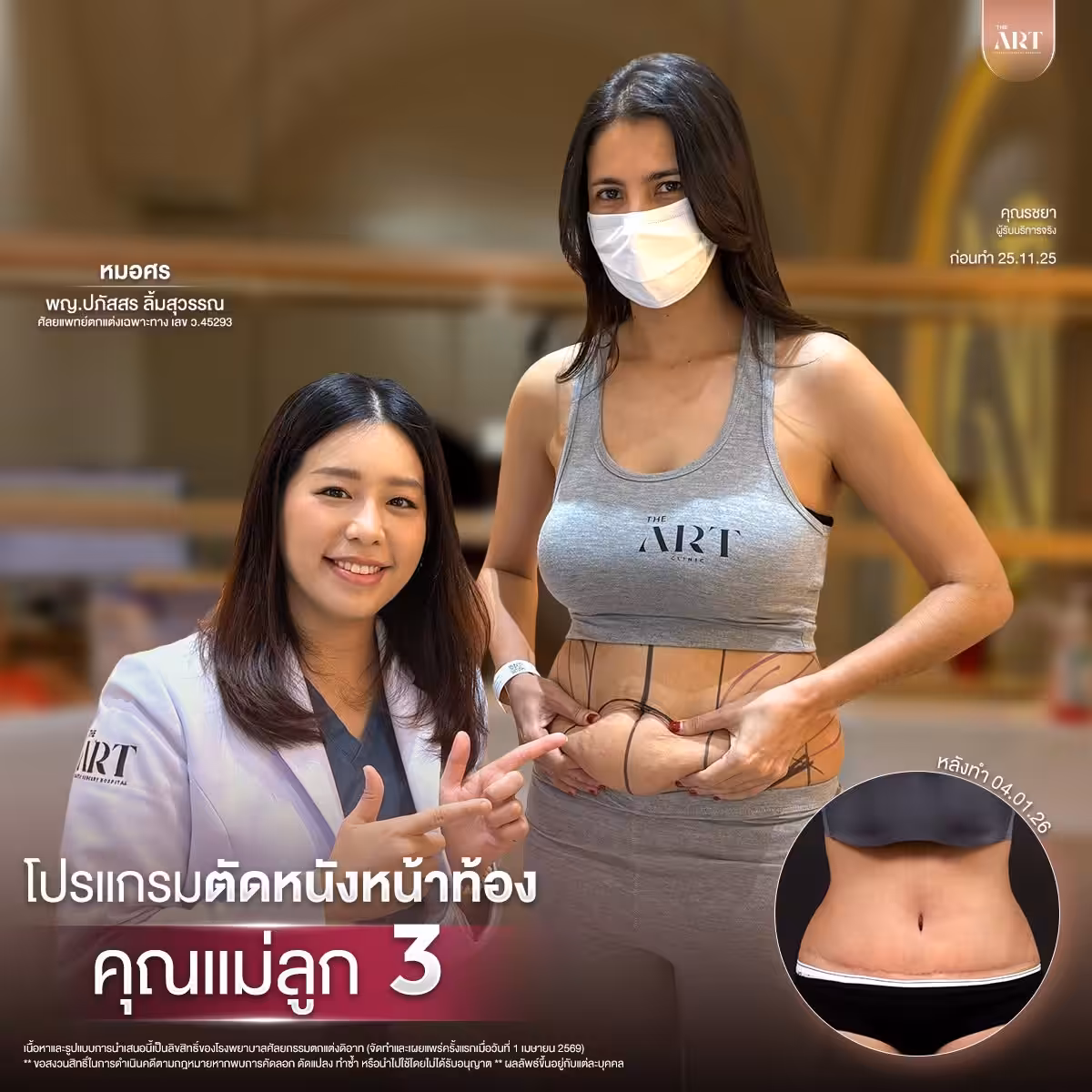 ตัดหนังหมอศร03