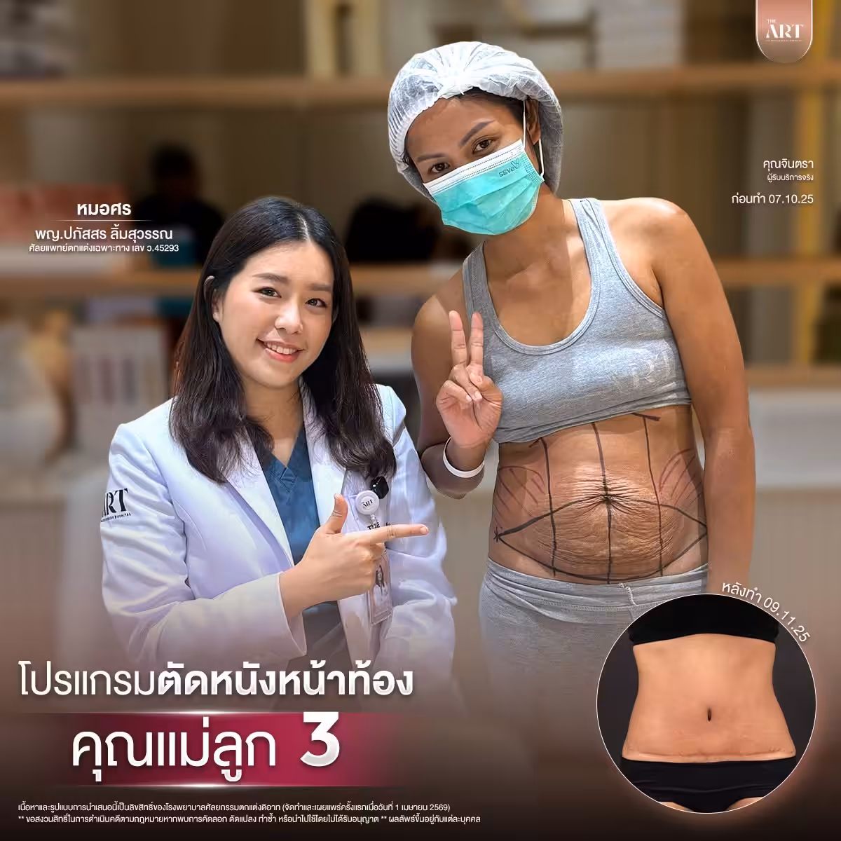 ตัดหนังหมอศร04