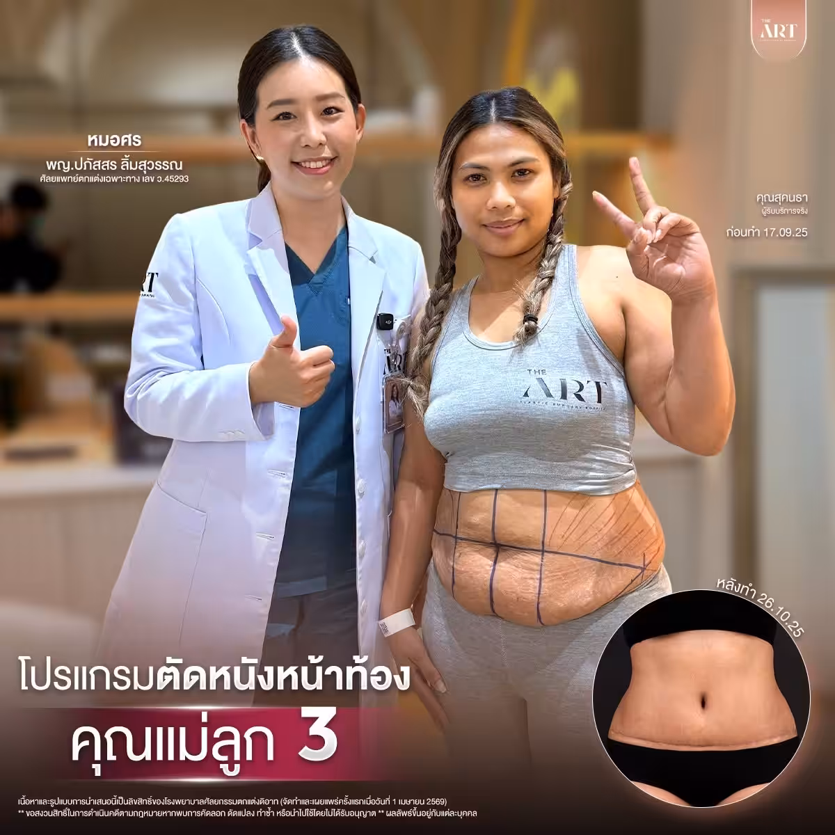 ตัดหนังหมอศร09