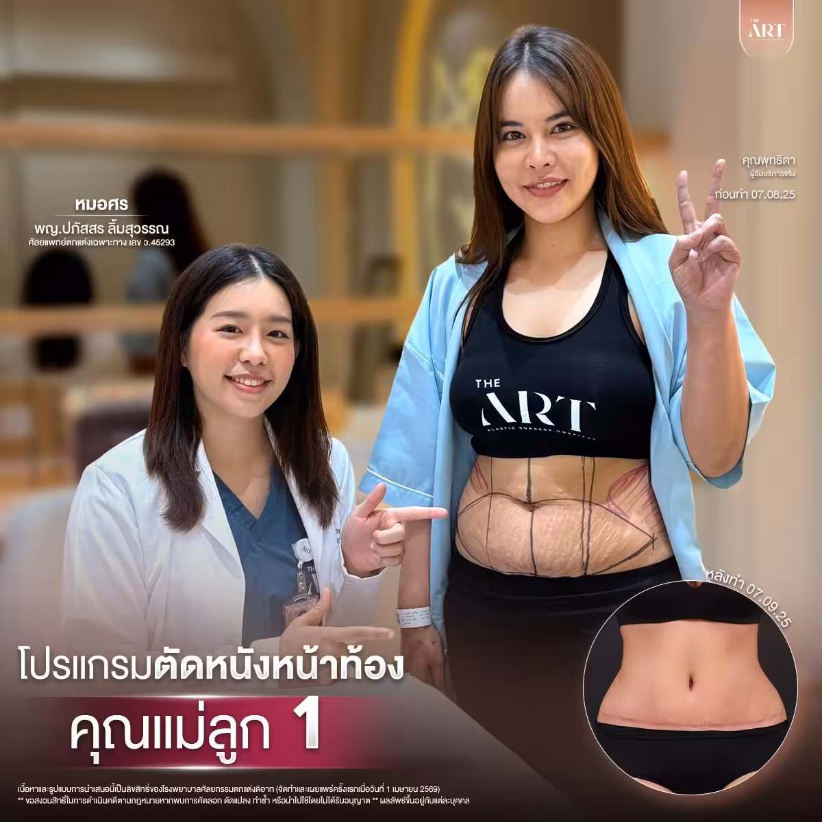 ตัดหนังหมอศร10