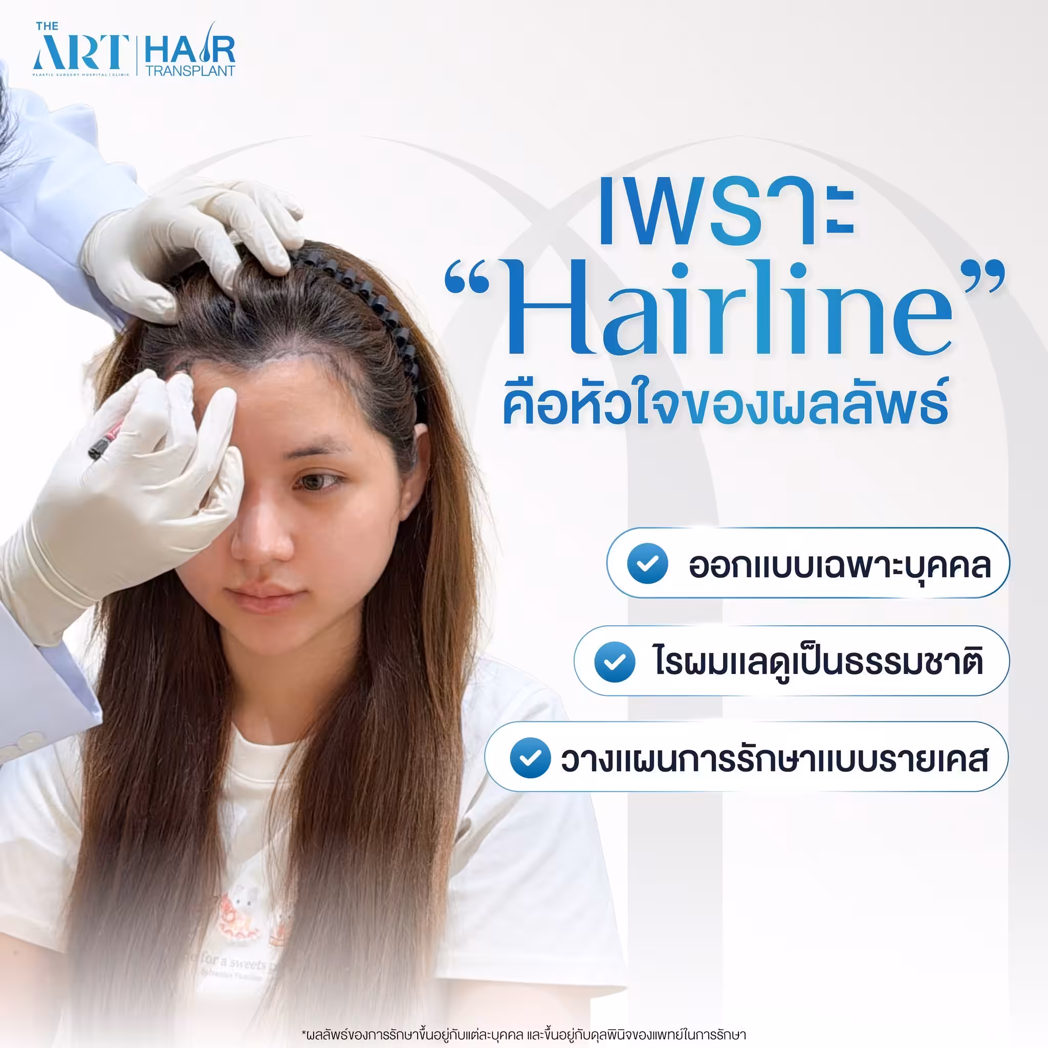 ปลูกผม ดิอาท 03