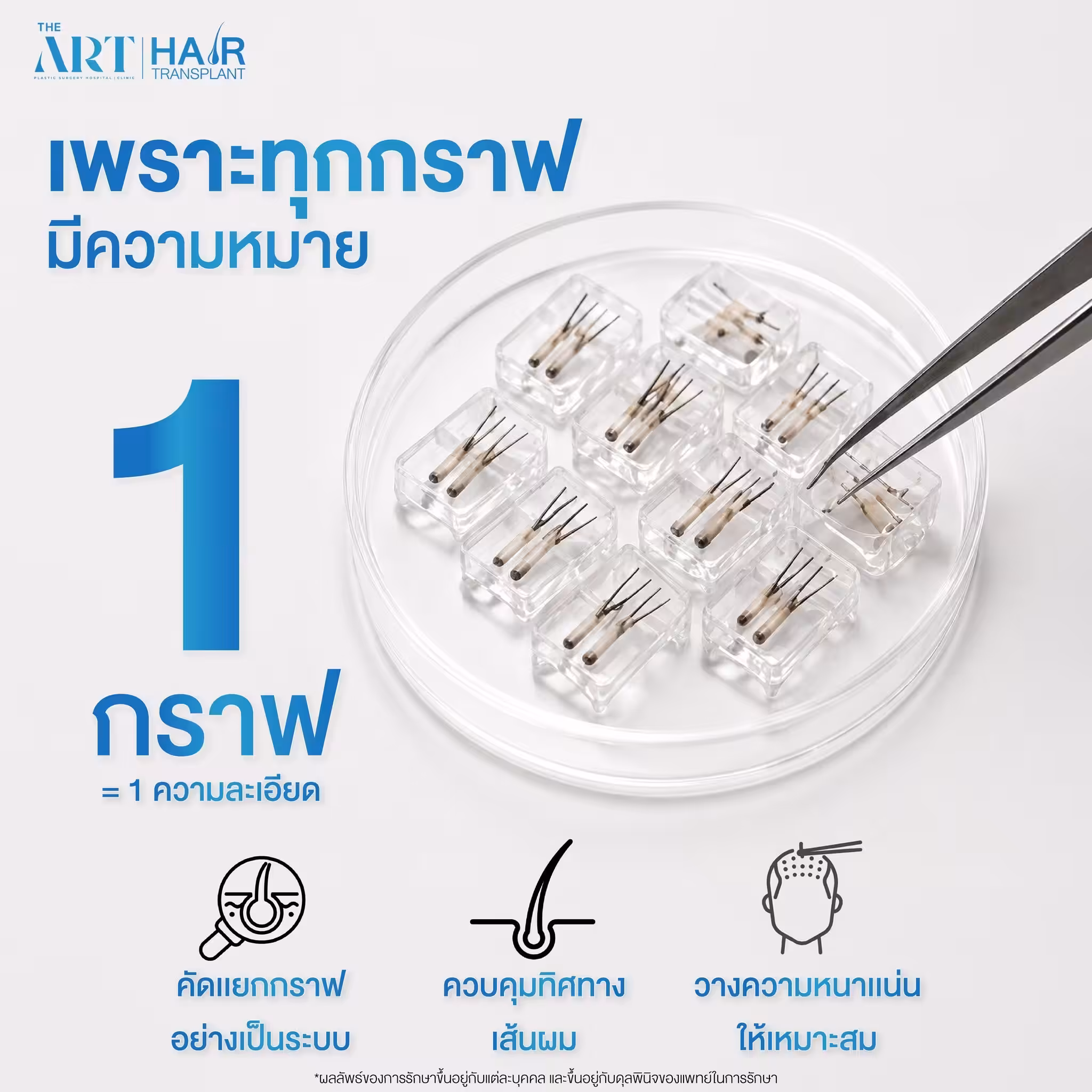 ปลูกผมดิอาท 02