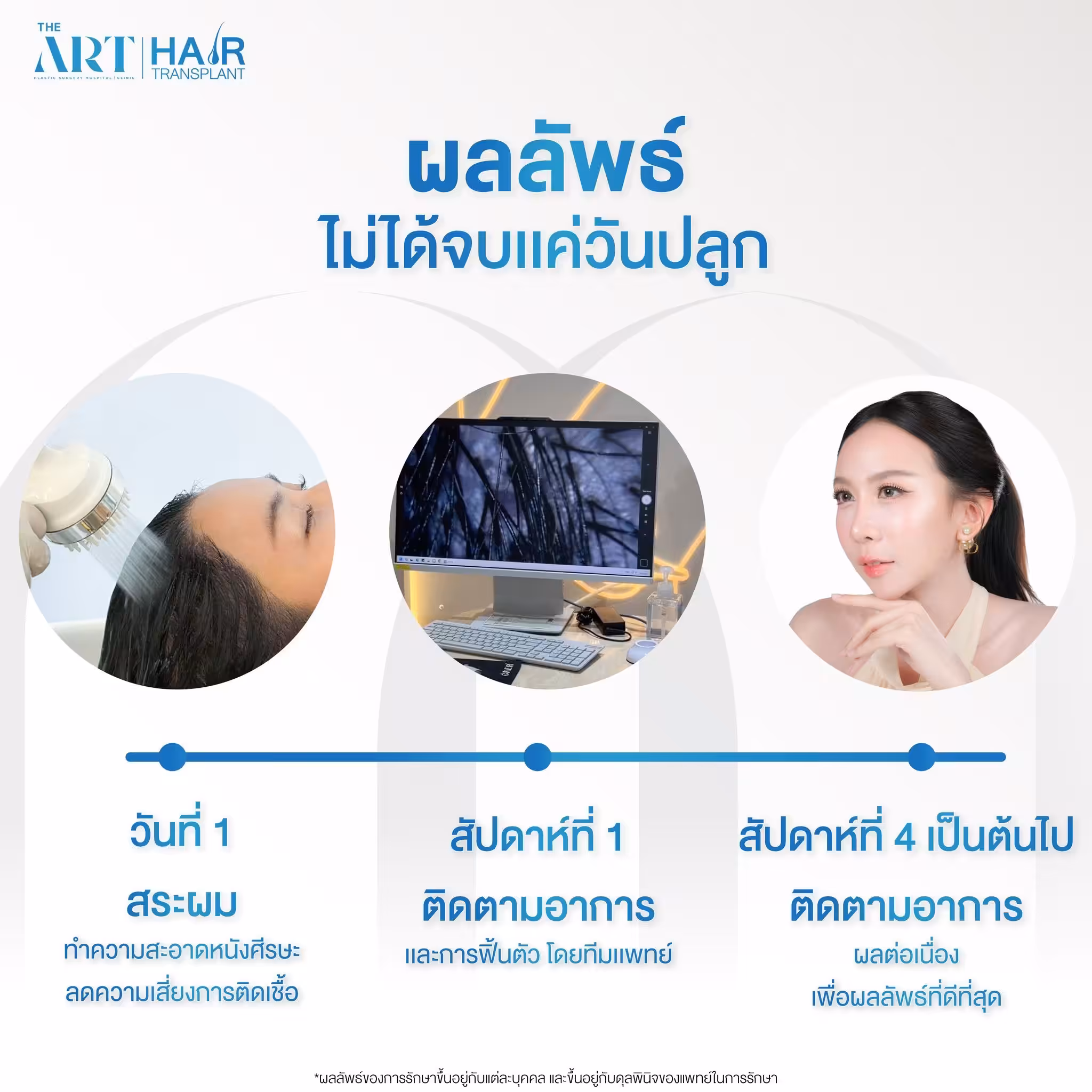 ปลูกผมดิอาท
