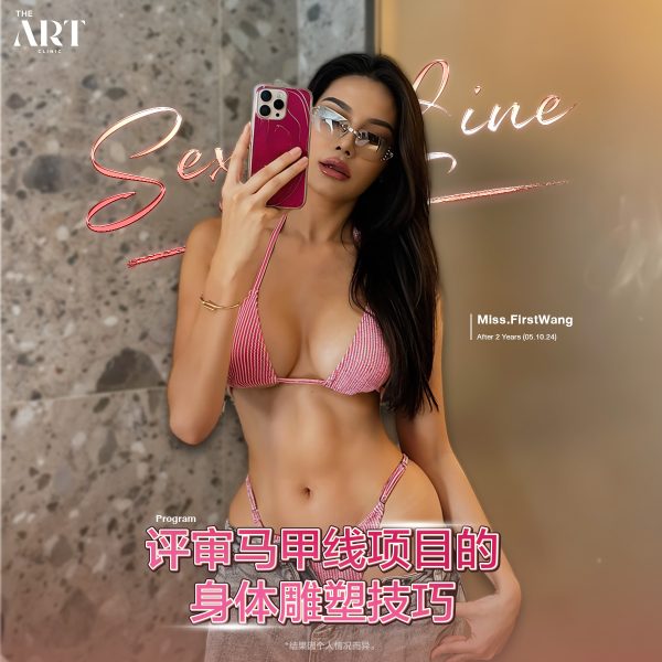 04_02_68 เฟริส์หวัง ดูดไขมัน (แฟนชั่น) CHI 1