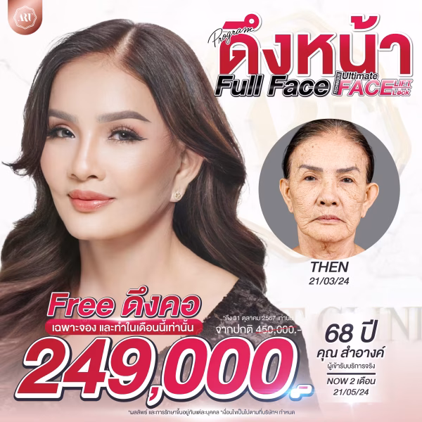 179 ดึงหน้า Full face 249