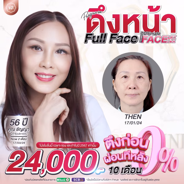 181 ผ่อนเริ่มต้น 24900