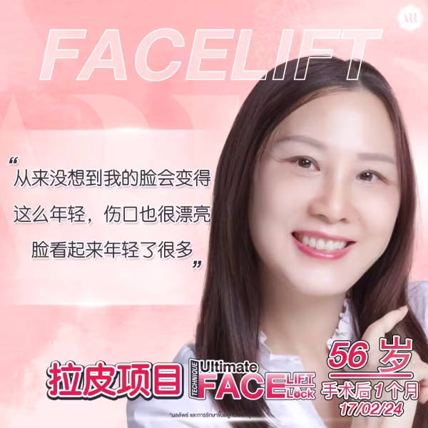 拉皮除皱评价