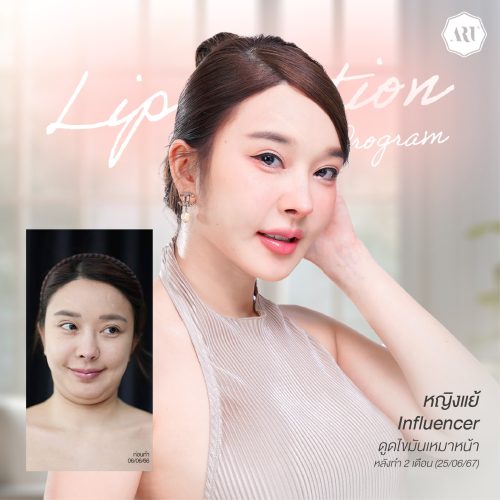 451023883_463968566390052_8198319871652051970_n