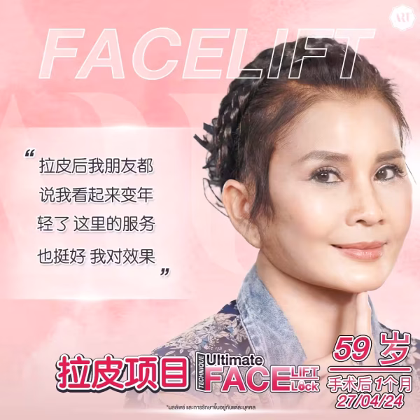 拉皮除皱评价