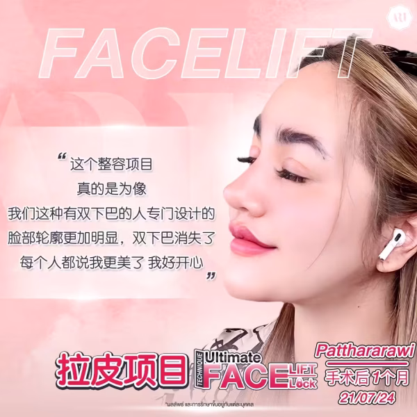 拉皮除皱评价