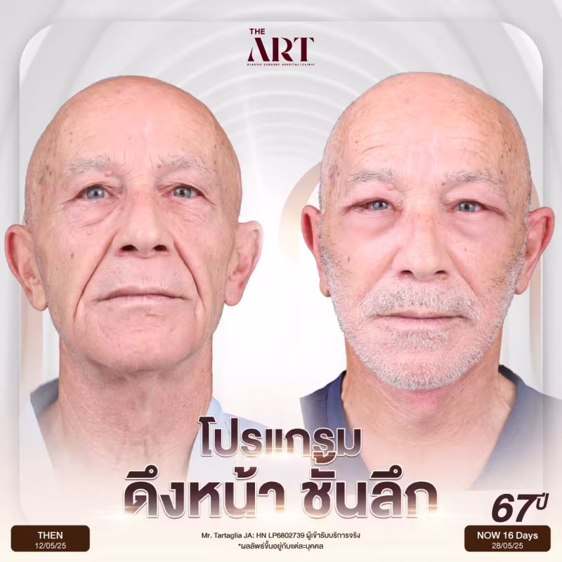 โปรแกรมดึงหน้าชั้นลึก