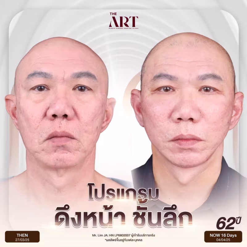 โปรแกรมดึงหน้าชั้นลึก