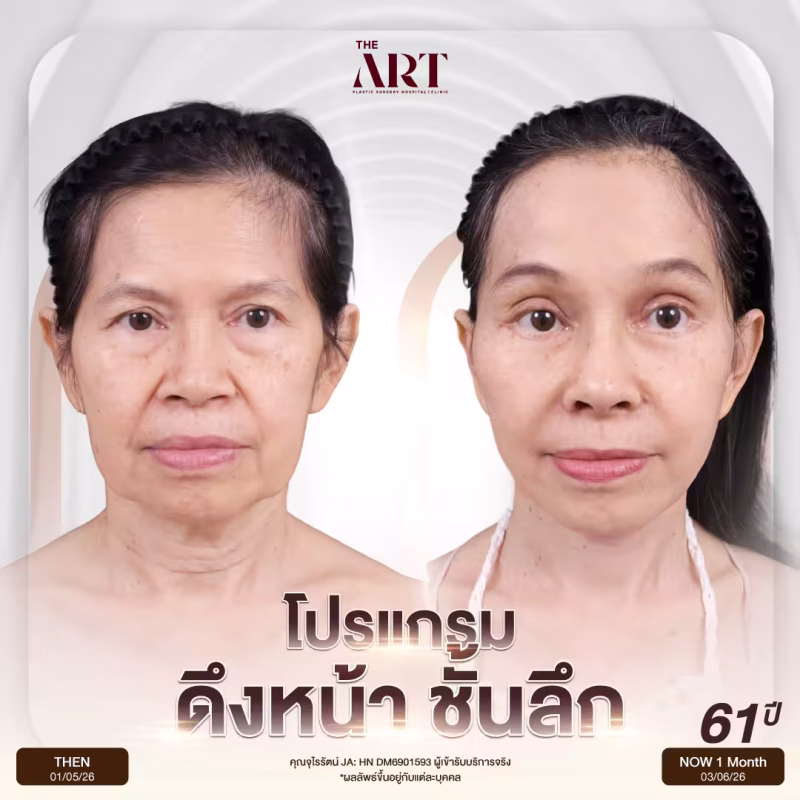 โปรแกรมดึงหน้าชั้นลึก