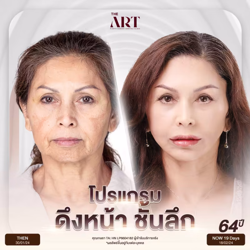 โปรแกรมดึงหน้าชั้นลึก