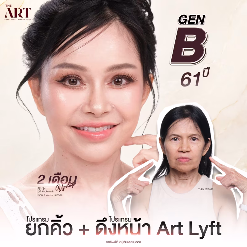 GP รวมหมอ แม่นุ้ย แม่จุง ออม ยกคิ้ว ทำคู่หัต