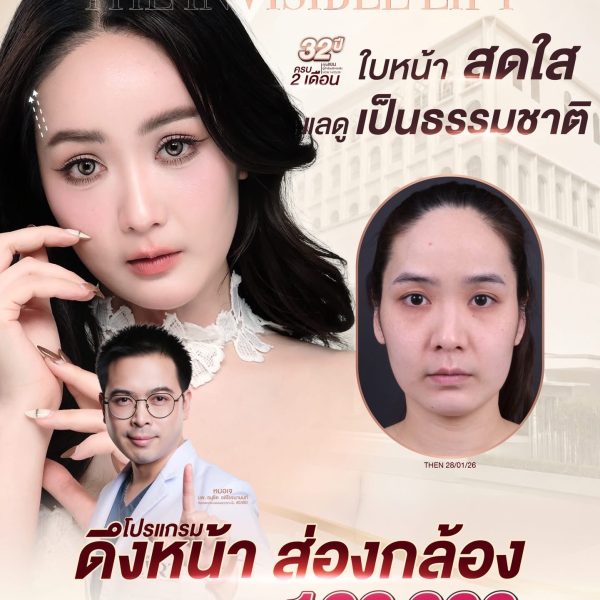 ดึงหน้า Full Face ส่องกล้อง 199,000