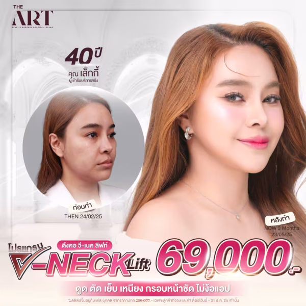 โปรแกรมยกคิ้ว Endotine ที่ The Art Hospital พร้อมเทคนิคส่องกล้อง Endosculpt ราคาโปรโมชัน 89,000 บาท